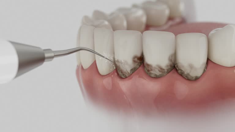 Trusted Teeth Cleaning And Checkup service in Folly Beach, SC - Dentist Open Now